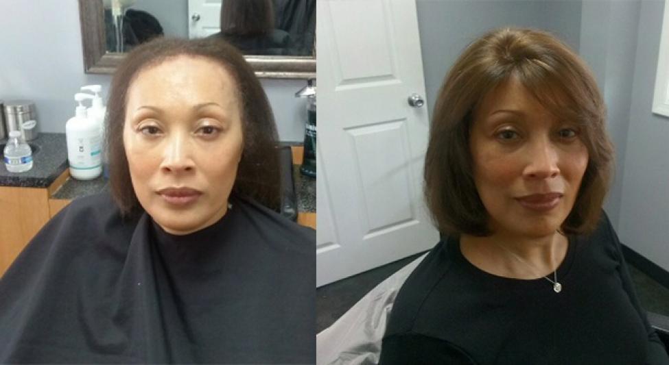 Transitions Hair Solutions Specialize In 3D Hair &amp;amp; Scalp Restoration