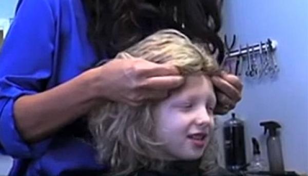 Alopecia and Children&amp;#039;s Hair Loss