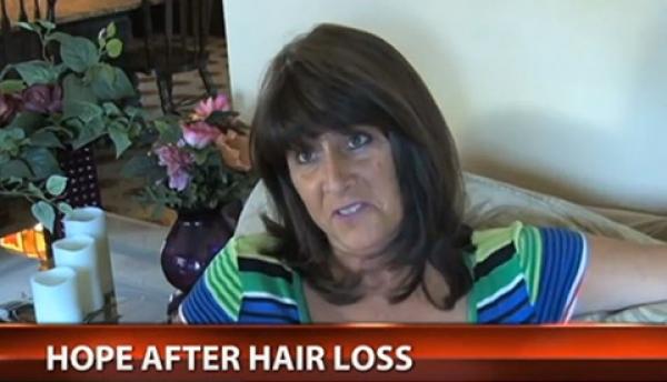 Hair System Helps Woman Recover After Cancer Treatment
